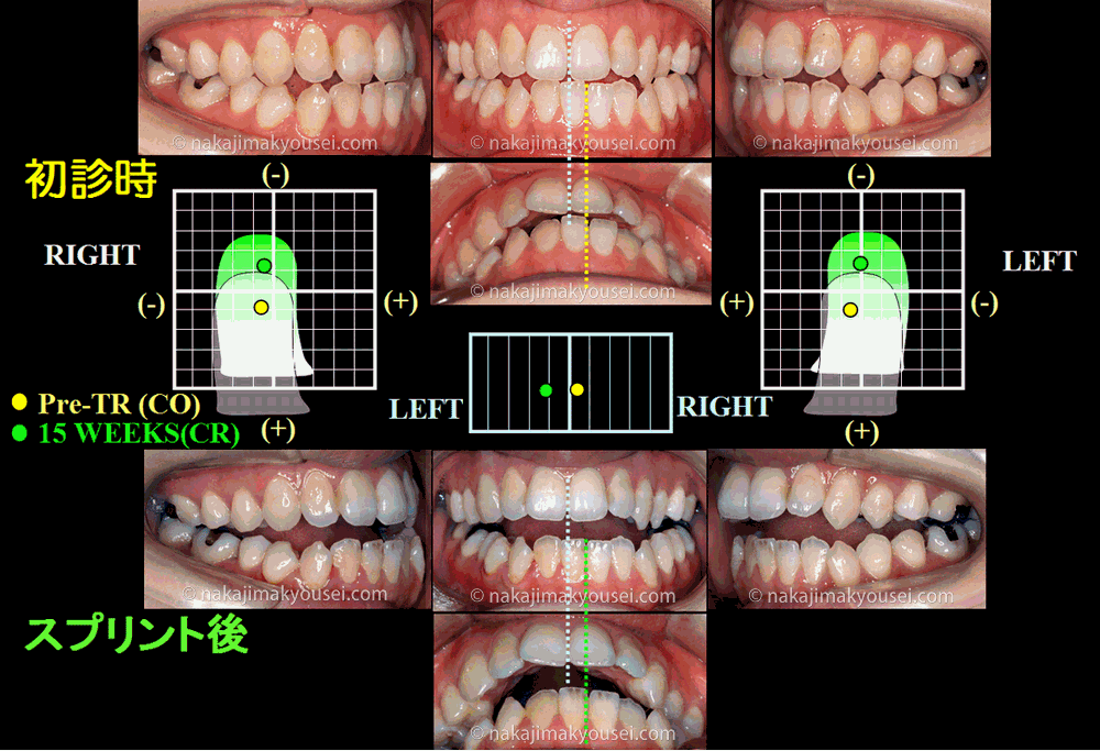 ֐ߓ֐|ɃV[ƂƂɂAoł{̃YmFłĂ܂B̃Y͑傫